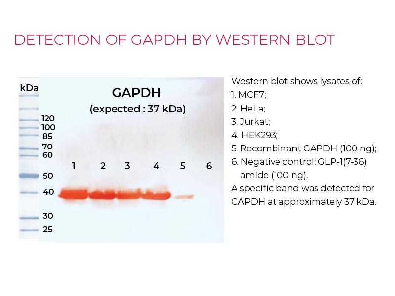 Detection GAPDH by Western-blot